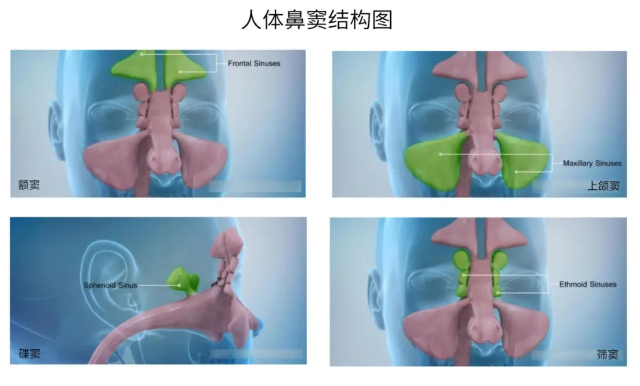 人体鼻窦结构图