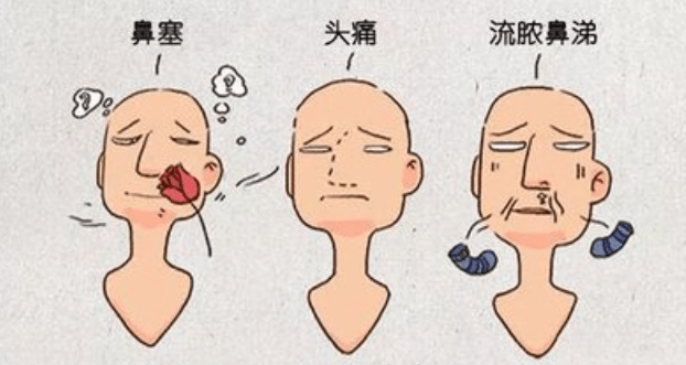常见的鼻炎类型有哪些？