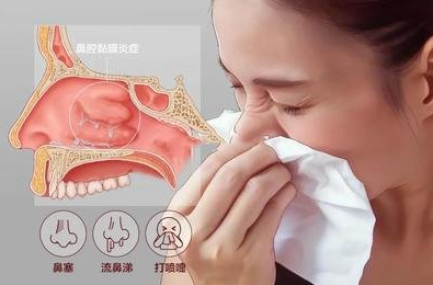 清鼻堂：鼻窦炎反复发作太难受，六个方法缓解鼻窦炎！