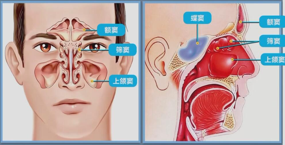 清鼻堂：鼻窦炎反复发作的危害有哪些？