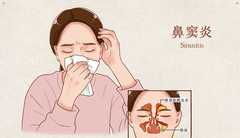 清鼻堂：鼻窦炎反复发作的致病因素有哪些？